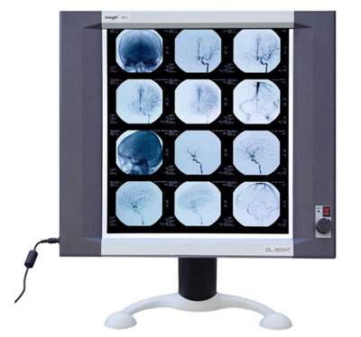 Shenzhen Reagol Bio-medical Instrument Single TFT LCD X-ray Film Viewer